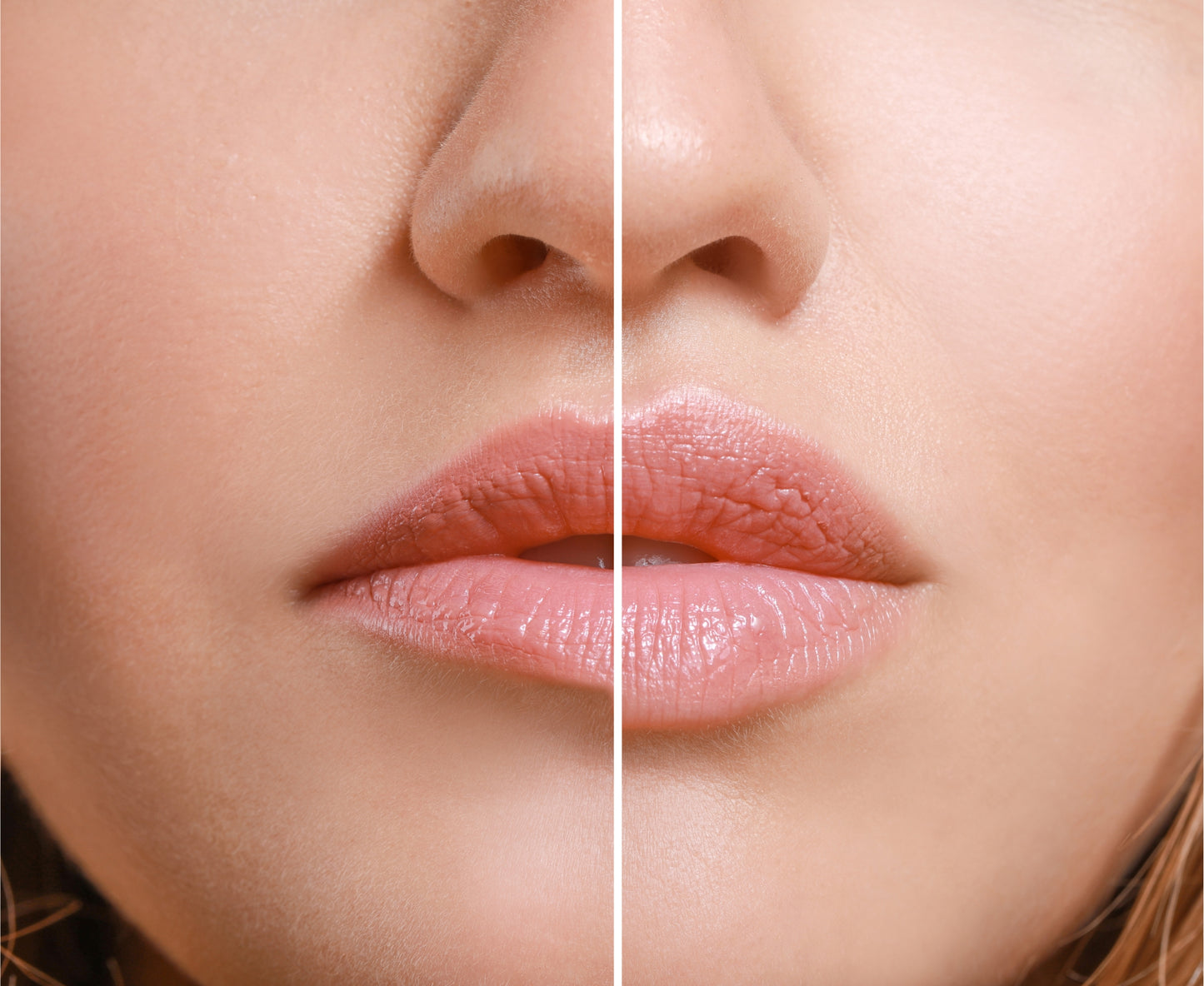 DOUBLE DELTA Lippenserum I Größere Lippen ohne Spritze